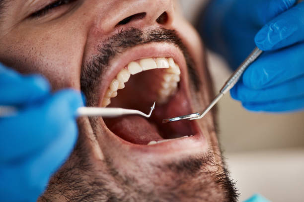 Best Emergency Dentist for Knocked-Out Tooth in Nanticoke, PA